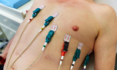 What Is An Electrocardiogram?